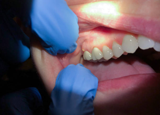 Best Tooth Pain Emergency Relief  in Silver Lake, NJ